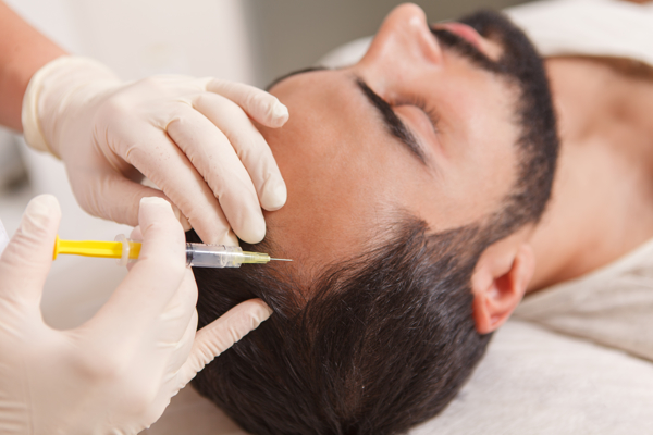 Meso-haartherapie door Inches by Brenda - d&eacute; salon in Helmond, Noord-Brabant